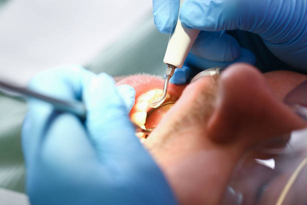 Best Emergency Denture Repair in Laurel Hill, NC