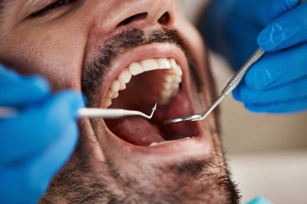 Best Emergency TMJ Treatment in Laurel Hill, NC