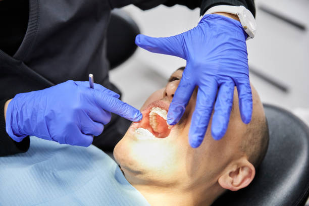Best Emergency Gum Treatment in Laurel Hill, NC